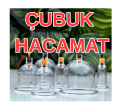 Hacamat Bu Kadar İyi Olabilir mi?